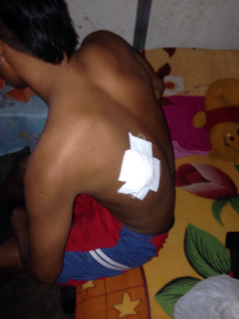 Trabajador herido en una de las arremetidas de los indígenas a la hacienda García Arriba  